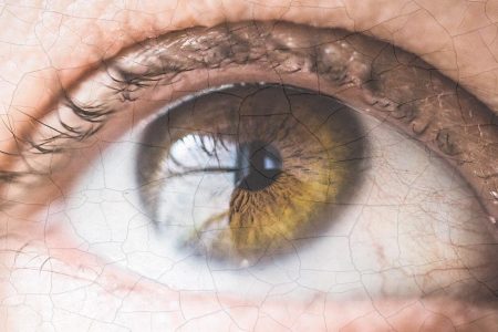 OCHIUL USCAT – SIMPTOME ȘI FACTORI DE RISC